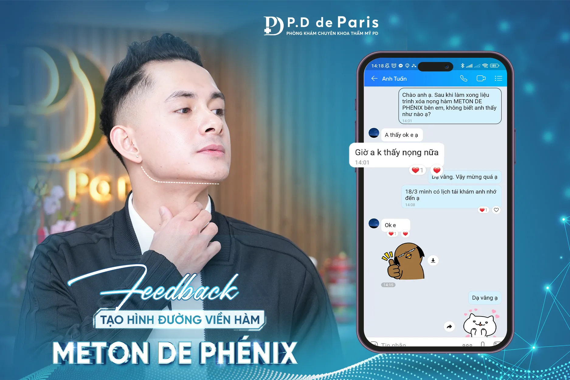 Xoá nọng cằm an toàn, không xâm lấn với Công nghệ Meton de Phénix tại P.D de Paris