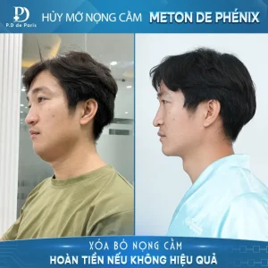 P.D de Paris – Hành trình 10 năm phát triển thương hiệu thẩm mỹ Quốc tế chuẩn Pháp