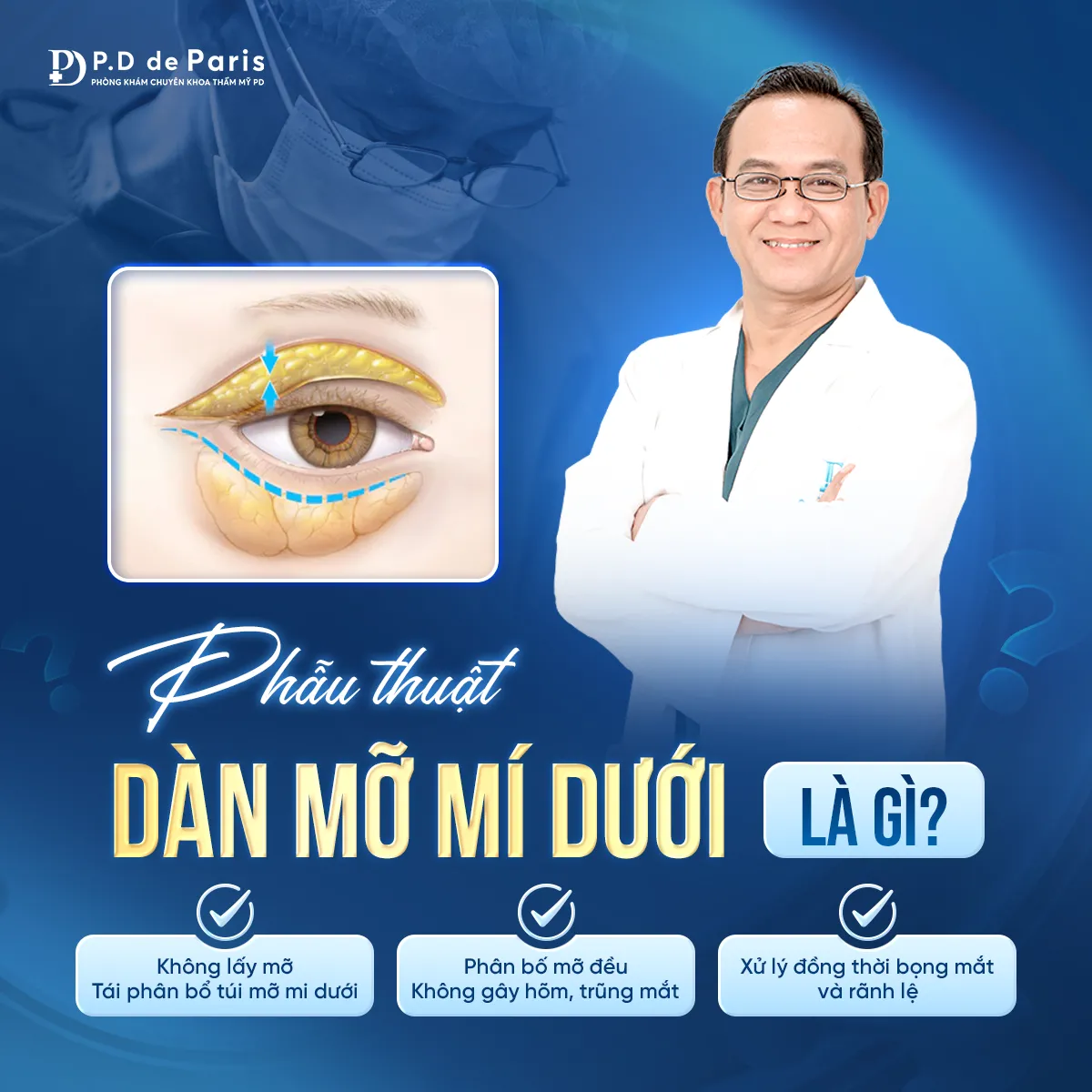 Dàn Mỡ Mí Dưới Là Gì? Khác Gì So Với Cắt Mí Dưới Truyền Thống? Chuyên Gia PD de Paris Giải Đáp!