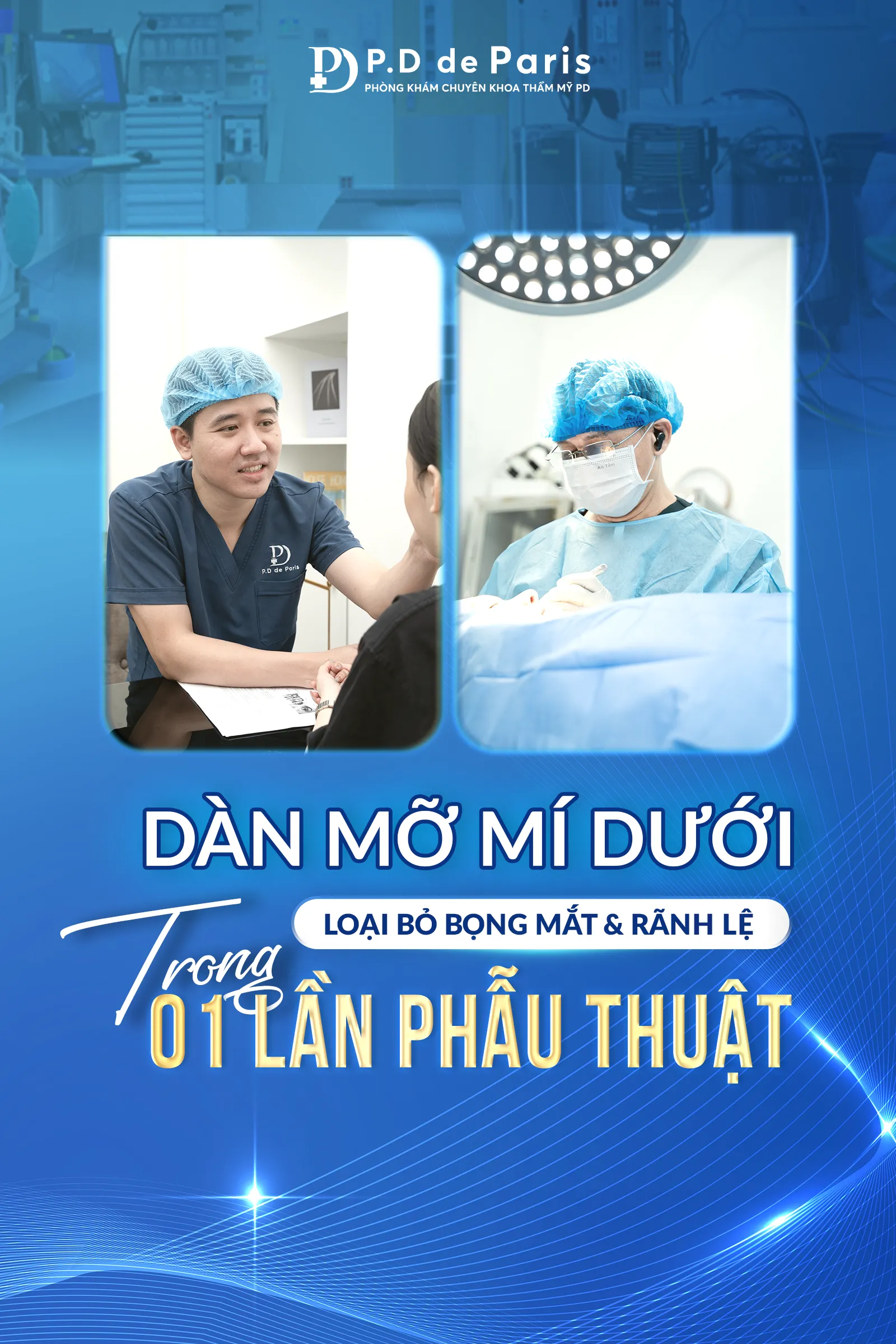 Dàn mỡ mí dưới là gì? Quy trình và công nghệ độc quyền tại P.D De Paris