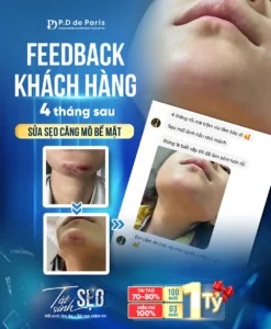 Sửa sẹo căng mô bề mặt có đau không? Thực hư cảm giác khi trải nghiệm dịch vụ tại phòng khám PD de Paris