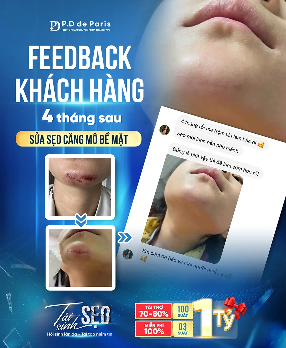 Sửa sẹo căng mô bề mặt có đau không? Thực hư cảm giác khi trải nghiệm dịch vụ tại phòng khám PD de Paris