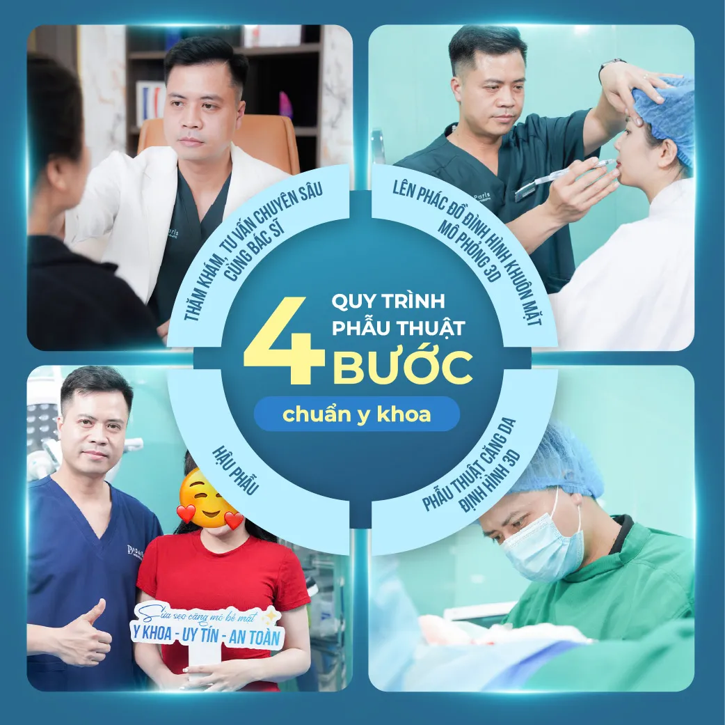 Căng da mặt 3D định hình là gì? Ưu và nhược điểm của phương pháp này