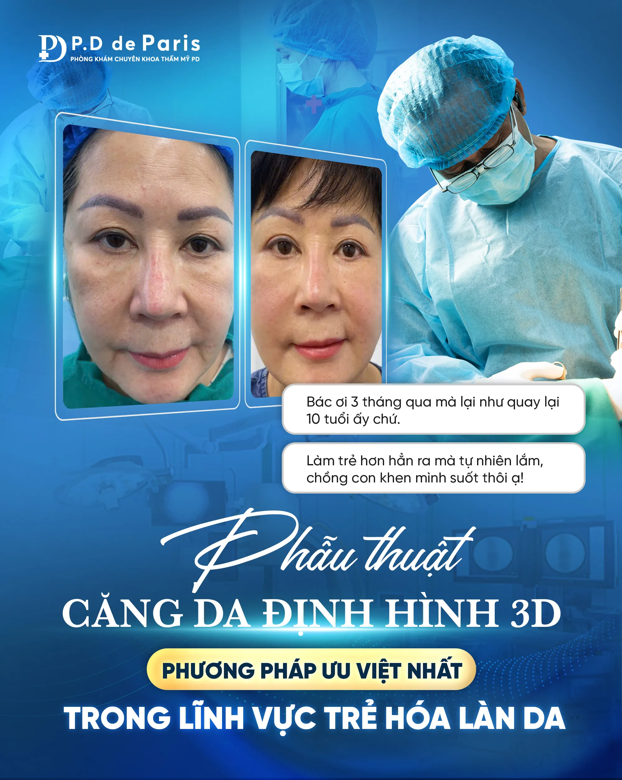 Căng da mặt 3D định hình là gì? Ưu và nhược điểm của phương pháp này