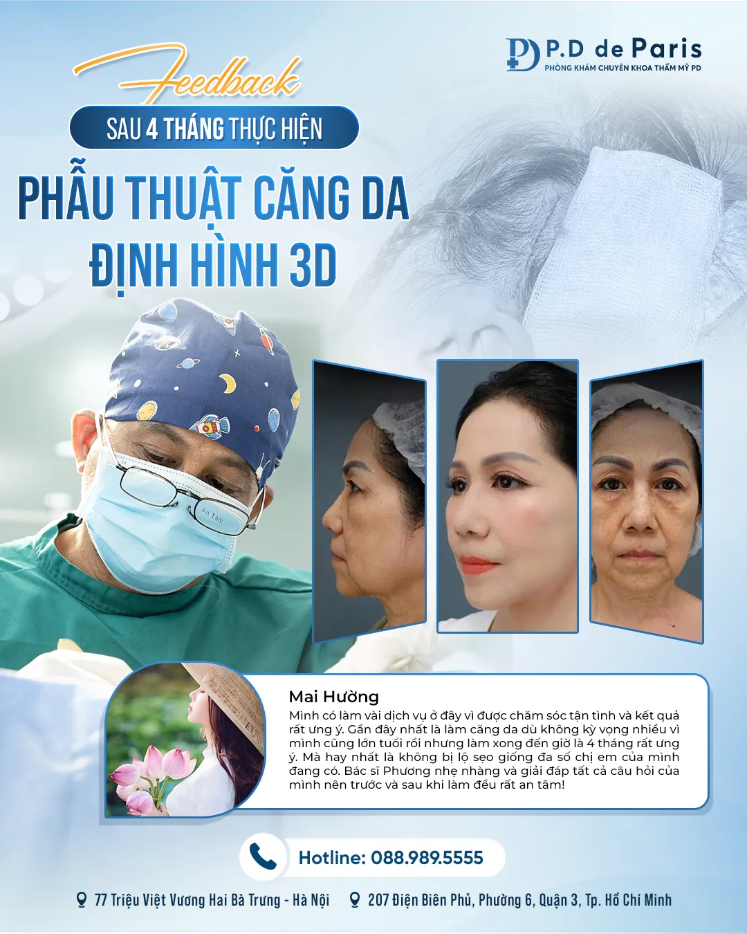 Căng da mặt định hình 3D ở đâu uy tín? Giá bao nhiêu?