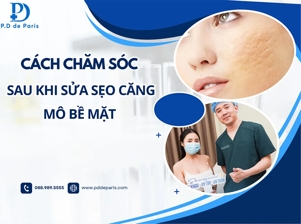 Hướng dẫn cách chăm sóc sau khi sửa sẹo căng mô bề mặt tại nhà