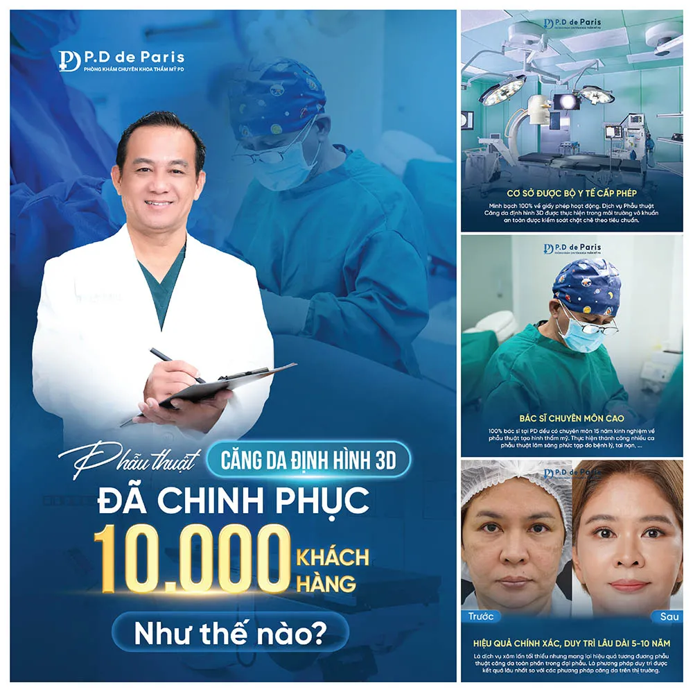 Căng da mặt 3D  cần nghỉ dưỡng bao nhiêu ngày?