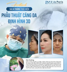 Khi nào thì nên thực hiện căng da mặt định hình 3D, độ tuổi nào là phù hợp nhất?