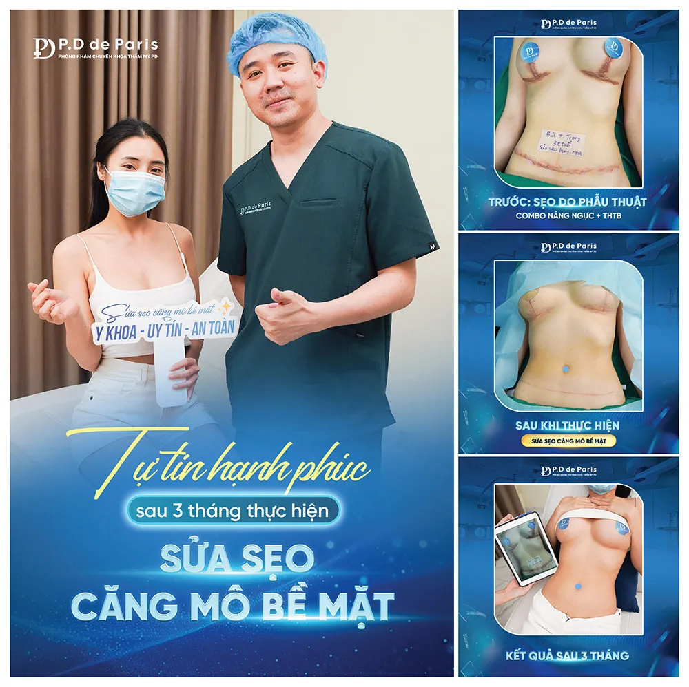 Hướng dẫn cách chăm sóc sau khi sửa sẹo căng mô bề mặt tại nhà