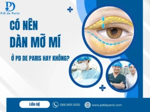 Có nên dàn mỡ mí dưới ở PD De Paris hay không?
