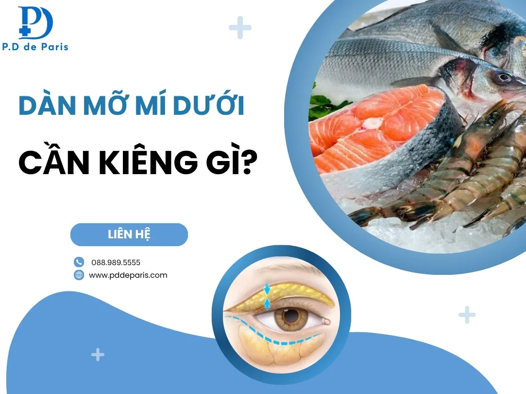 Dàn mỡ mí dưới cần kiêng gì? Những lưu ý quan trọng để mắt hồi phục nhanh và tự nhiên
