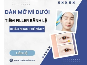 Dàn mỡ mí dưới khác gì so với tiêm Filler vùng rãnh lệ? Ưu và nhược điểm từng phương pháp