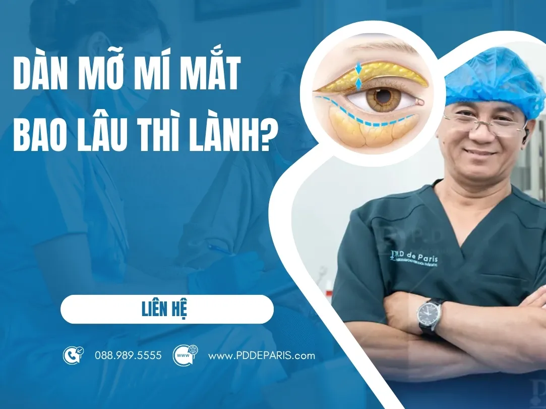Dàn mỡ mí mắt bao lâu thì lành? Dàn mỡ mí mắt có để lại sẹo không?