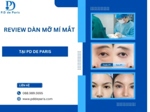 Review dàn mỡ mí mắt được thực hiện tại PD De Paris ?