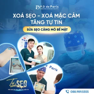 Đối tượng nên thực hiện sửa sẹo căng mô bề mặt là ai?
