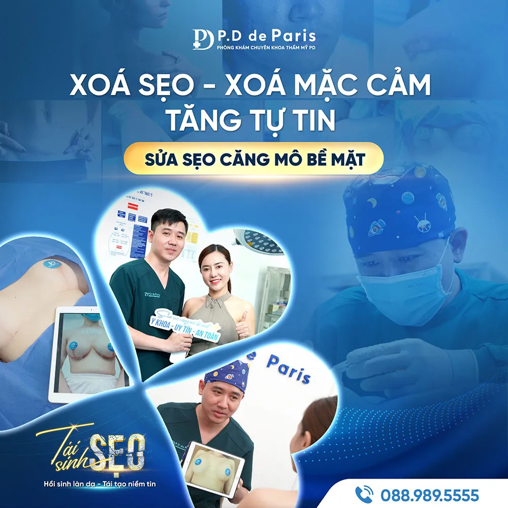 Đối tượng nên thực hiện sửa sẹo căng mô bề mặt là ai?