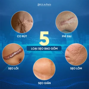 Sửa sẹo căng mô bề mặt có cần nghỉ dưỡng sau khi thực hiện không?