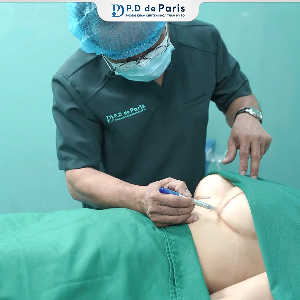 Sửa sẹo căng mô bề mặt ở đâu uy tín? Giá bao nhiêu?