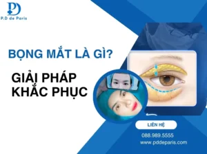 Bọng mắt là gì? Nguyên nhân, dấu hiệu và cách khắc phục hiệu quả