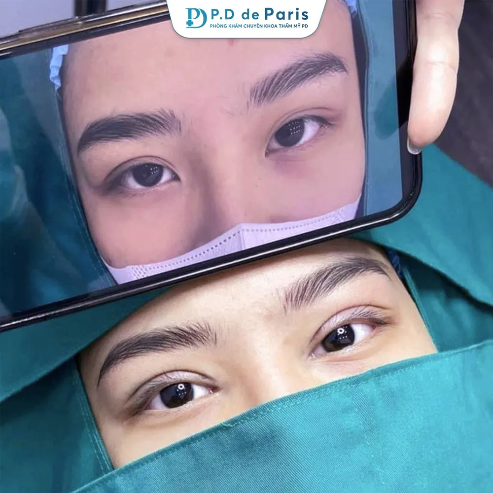 Vì sao hốc mắt sâu? Nguyên nhân và cách khắc phục hiệu quả nhất