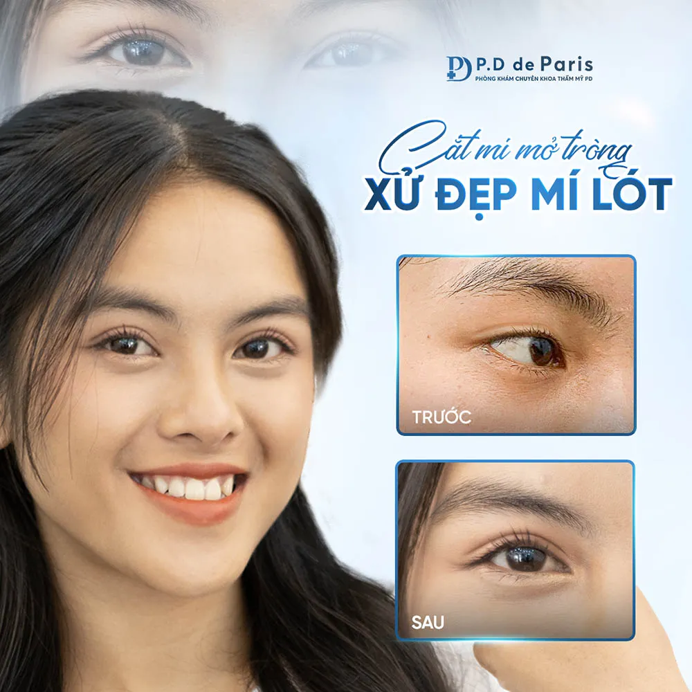 Vì sao hốc mắt sâu? Nguyên nhân và cách khắc phục hiệu quả nhất