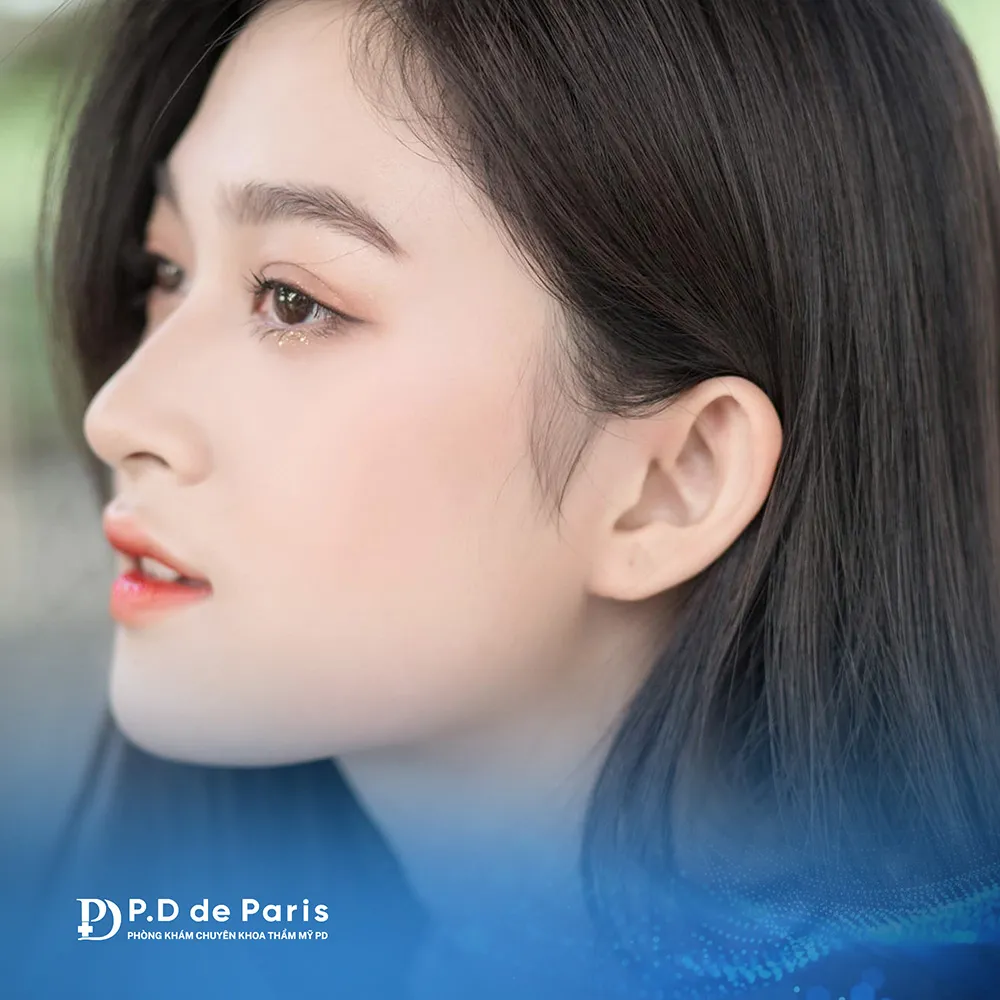 Vì sao hốc mắt sâu? Nguyên nhân và cách khắc phục hiệu quả nhất