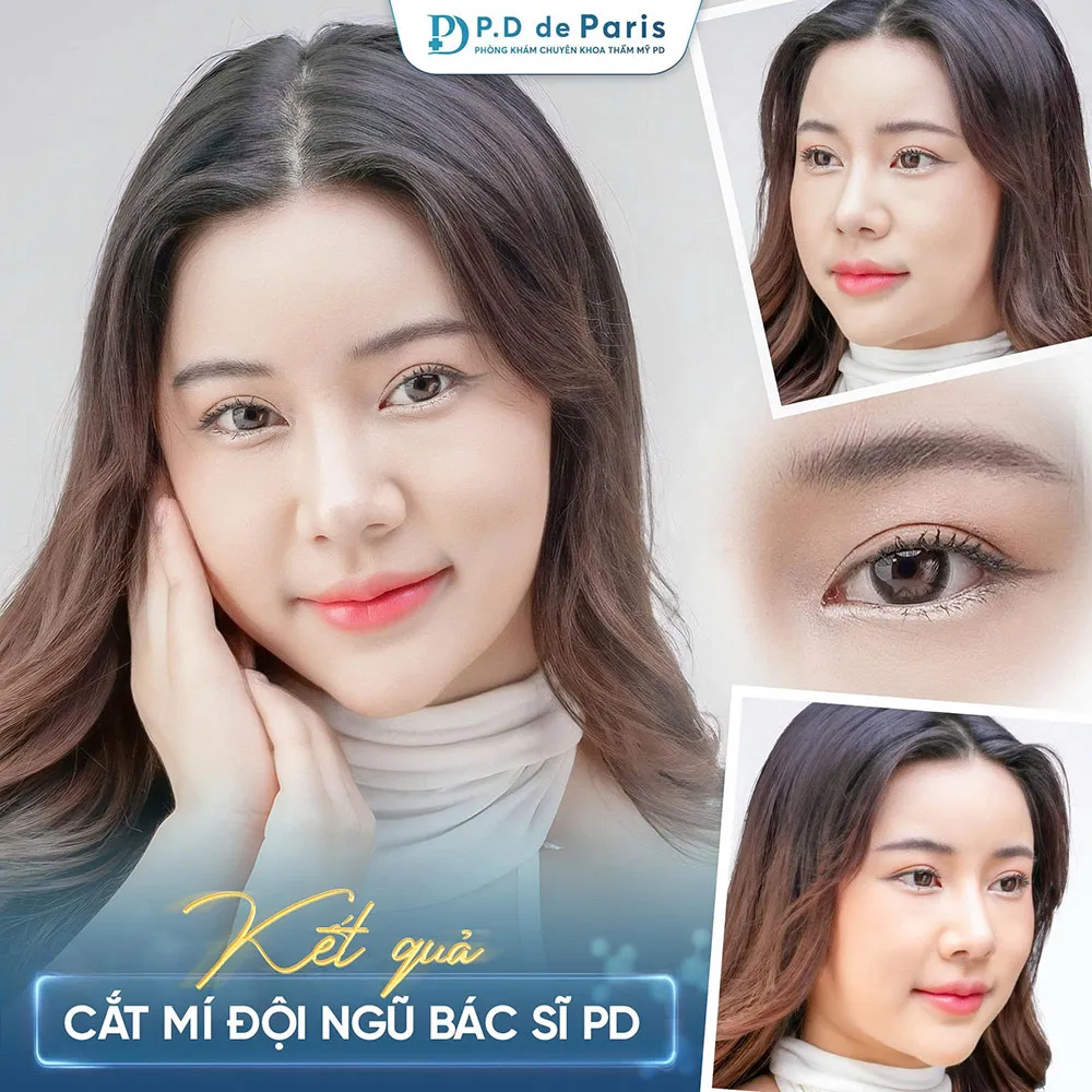 Vì sao hốc mắt sâu? Nguyên nhân và cách khắc phục hiệu quả nhất