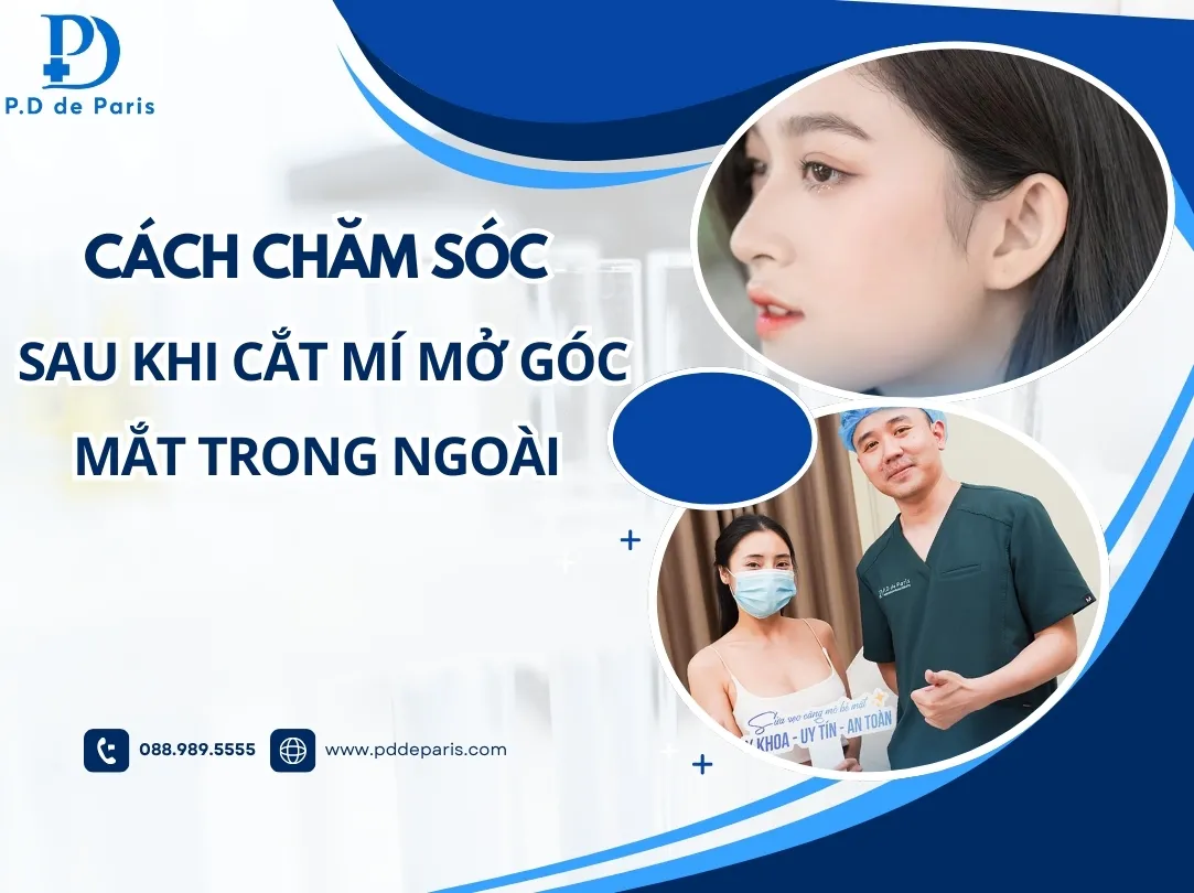 Hướng dẫn cách chăm sóc sau khi cắt mí mở góc mắt đơn giản tại nhà