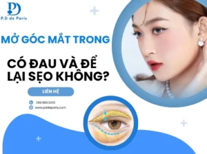 Mở góc mắt trong, ngoài có đau và để lại sẹo không?