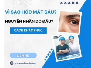 Vì sao hốc mắt sâu? Nguyên nhân và cách khắc phục hiệu quả nhất