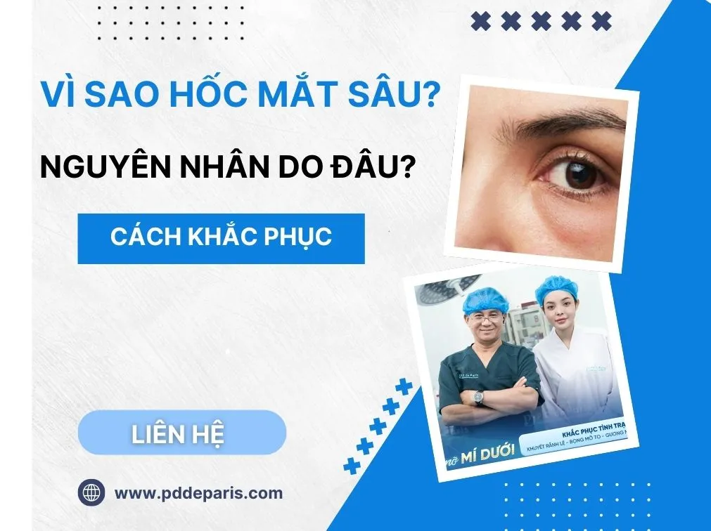 Vì sao hốc mắt sâu? Nguyên nhân và cách khắc phục hiệu quả nhất