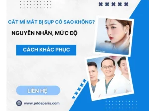 Cắt Mí Mắt Bị Sụp Có Sao Không? Nguyên Nhân, Mức Độ & Cách Khắc Phục