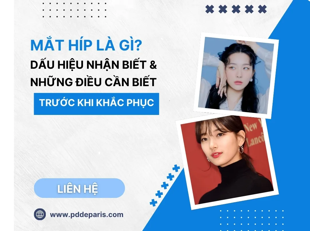Mắt Híp Là Gì? Dấu Hiệu Nhận Biết & Những Điều Cần Biết Trước Khi Khắc Phục