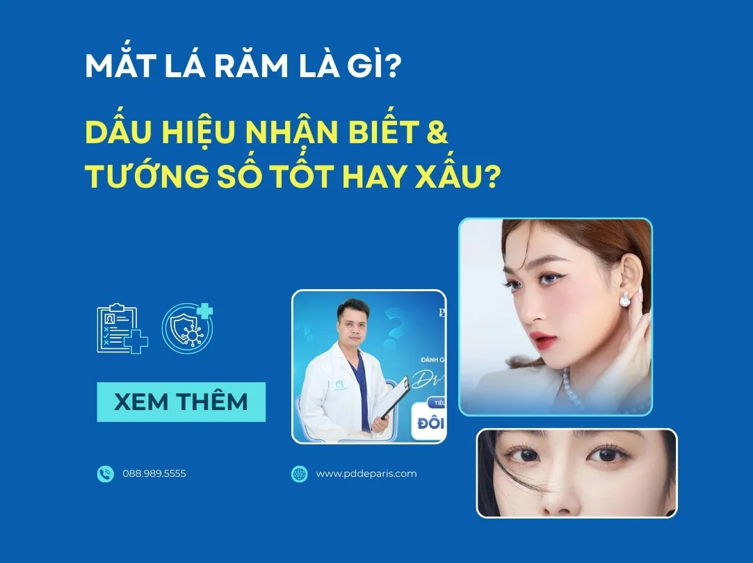 Mắt Lá Răm Là Gì? Dấu Hiệu Nhận Biết & Tướng Số Tốt Hay Xấu?