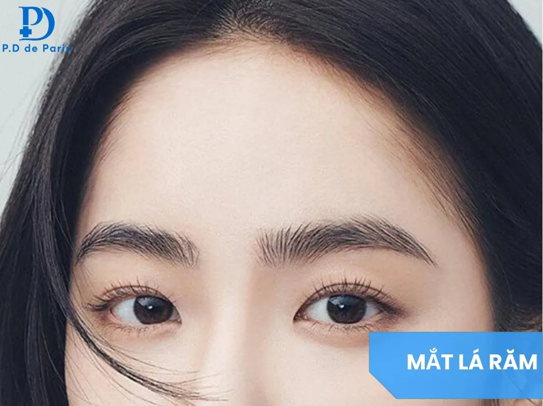 Mắt Lá Răm Là Gì? Dấu Hiệu Nhận Biết & Tướng Số Tốt Hay Xấu?