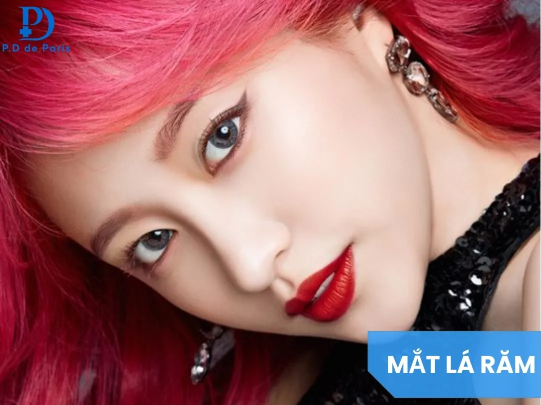 Mắt Lá Răm Là Gì? Dấu Hiệu Nhận Biết & Tướng Số Tốt Hay Xấu?