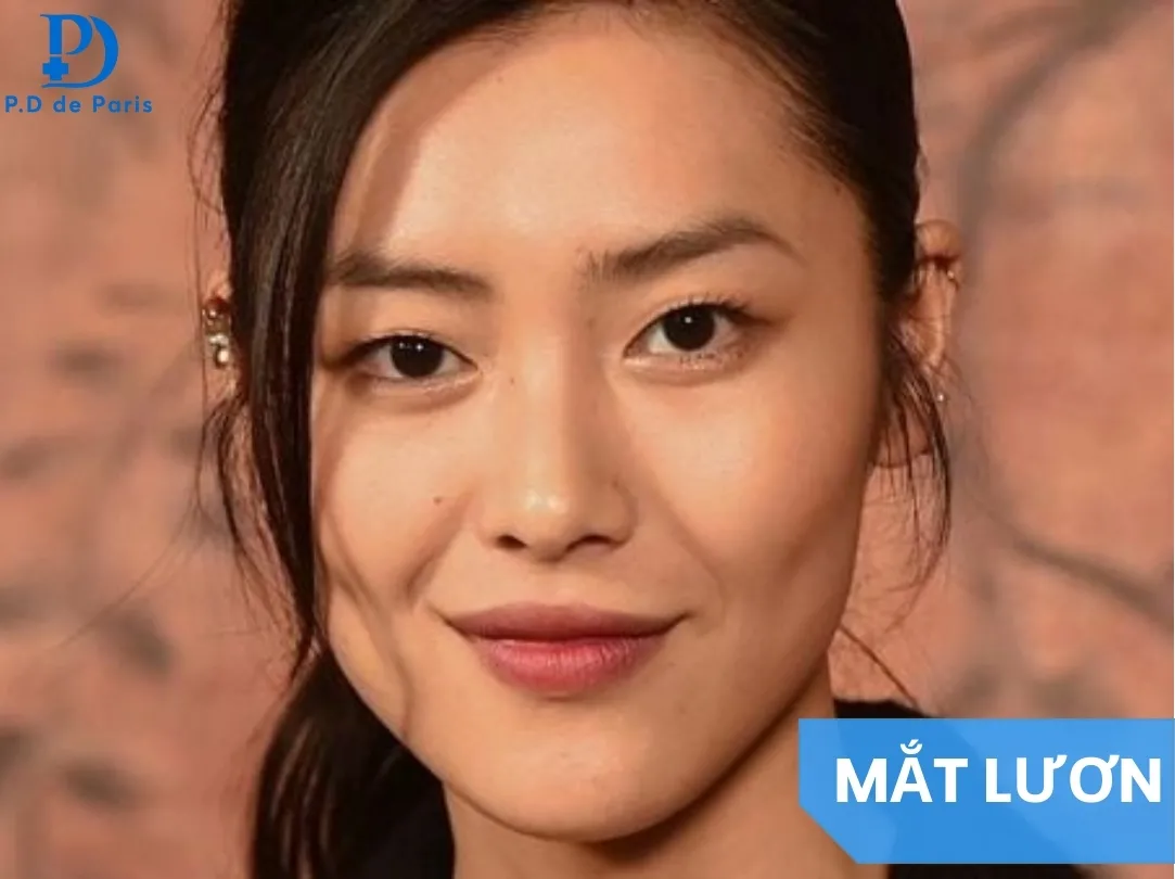 Mắt lươn là gì? Dấu hiệu nhận biết và có nên sửa tướng mắt lươn thay đổi vận số?