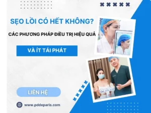 Sẹo Lồi Có Hết Không? Các Phương Pháp Điều Trị Hiệu Quả & Ít Tái Phát