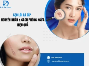 Sẹo Lồi Là Gì? Nguyên Nhân, Triệu Chứng Nhận Biết & Cách Phòng Ngừa Hiệu Quả