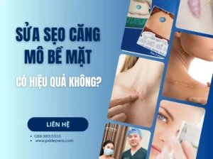 Sửa Sẹo Căng Mô Bề Mặt có hiệu quả không? Bao lâu thì lành và những điều cần biết