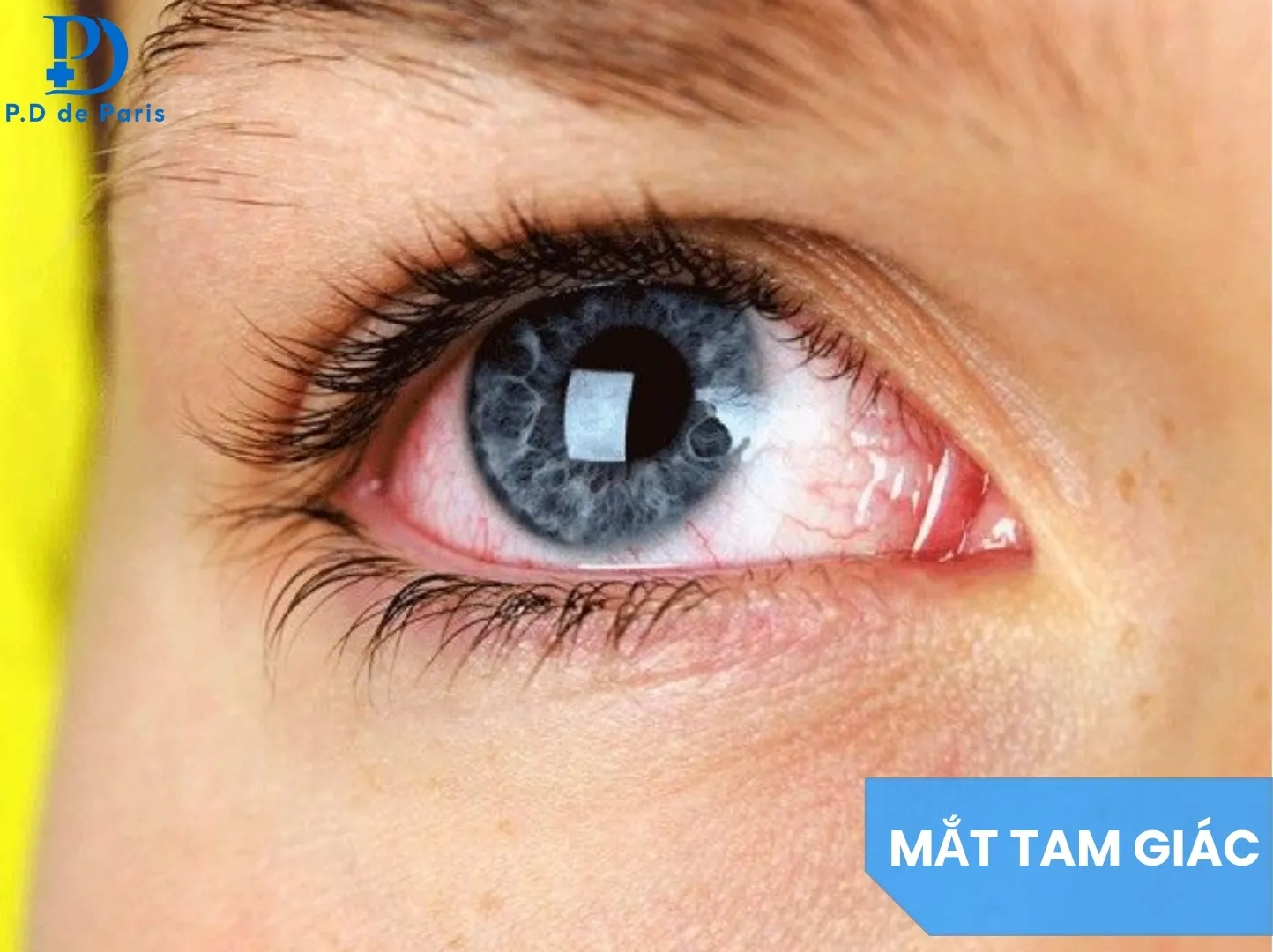 Tướng Mắt Tam Giác Là Gì? Vận Số Người Sở Hữu Tốt Hay Xấu?