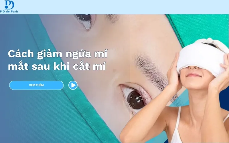 Cắt mí mắt xong bị ngứa có làm sao không?