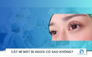Cắt mí mắt xong bị ngứa có làm sao không?