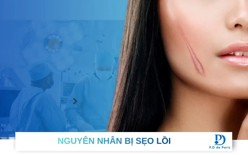 Sẹo lồi là gì? Làm thế nào để điều trị sẹo lồi hiệu quả?