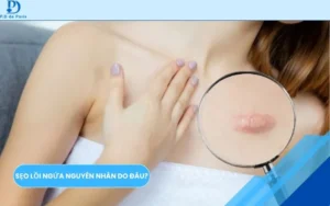 Sẹo lồi ngứa nguyên nhân do đâu? Những cách xử lý có hiệu quả an toàn lâu dài