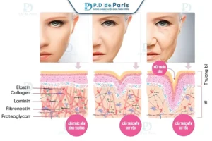 5 Ưu Điểm Vượt Trội Của Phương Pháp VECTORA Định Trục Nâng Cơ So Với Cách Trẻ Hóa Da Mặt Truyền Thống