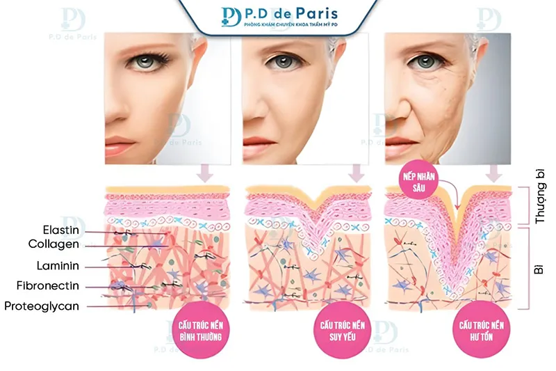 5 Ưu Điểm Vượt Trội Của Phương Pháp VECTORA Định Trục Nâng Cơ So Với Cách Trẻ Hóa Da Mặt Truyền Thống