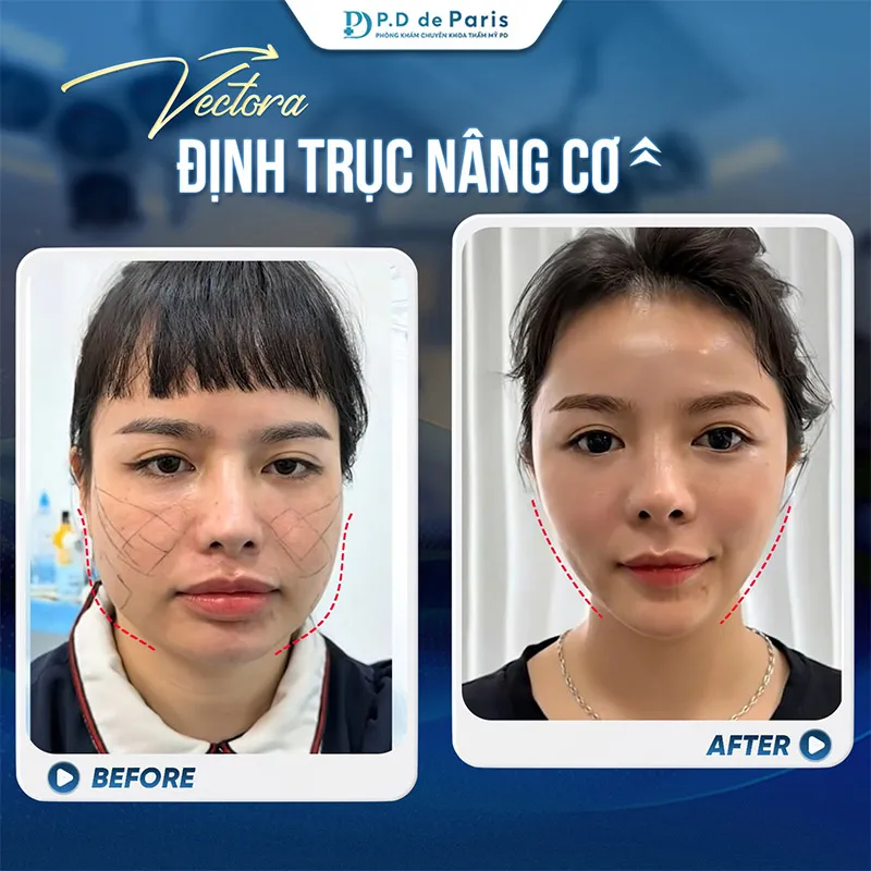 Phòng khám PTTM PD De Paris có uy tín và an toàn khi lựa chọn không?