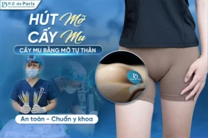 Cấy mỡ môi lớn kiêng ăn gì và nên ăn gì để vết thương mau lành?