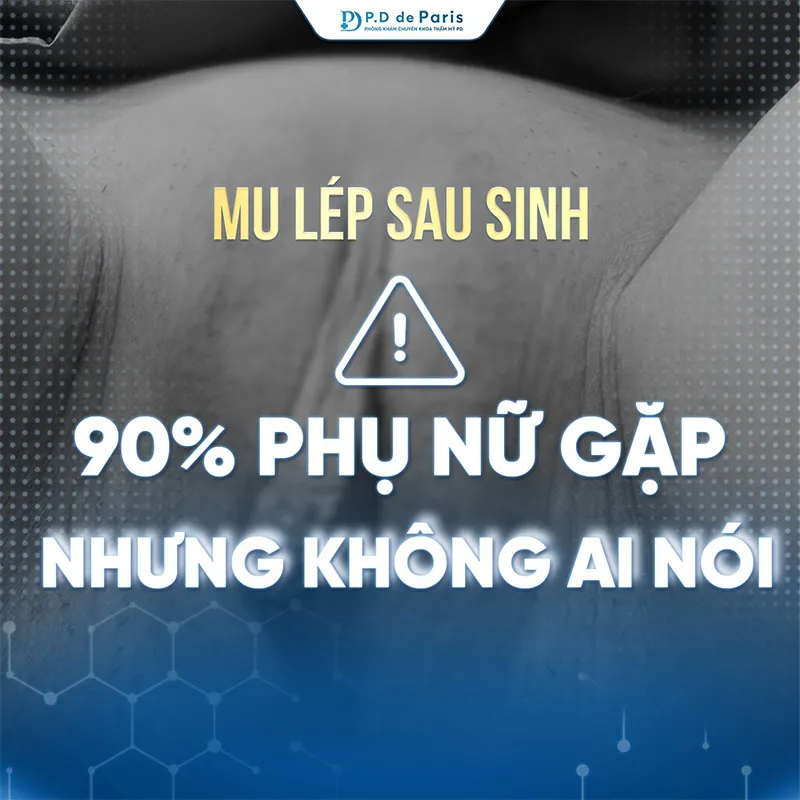 Cấy mỡ môi lớn kiêng ăn gì và nên ăn gì để vết thương mau lành?